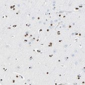 Anti-NFIA antibody produced in rabbit Prestige Antibodies® Powered by Atlas Antibodies, affinity isolated antibody, buffered aqueous glycerol solution