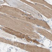 Anti-CA14 antibody produced in rabbit Prestige Antibodies® Powered by Atlas Antibodies, affinity isolated antibody, buffered aqueous glycerol solution