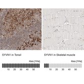 Anti-SYVN1 antibody produced in rabbit Prestige Antibodies® Powered by Atlas Antibodies, affinity isolated antibody, buffered aqueous glycerol solution