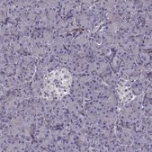 Anti-PGM5 Prestige Antibodies® Powered by Atlas Antibodies, affinity isolated antibody