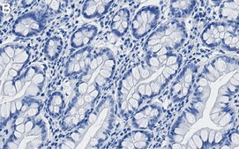 Anti-ALIX/PDCD6IP Antibody, clone 1D11 ZooMAb® Rabbit Monoclonal recombinant, expressed in HEK 293 cells