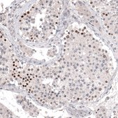Monoclonal Anti-PRAME antibody produced in mouse Prestige Antibodies® Powered by Atlas Antibodies, clone CL5148, purified immunoglobulin, buffered aqueous glycerol solution
