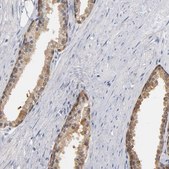 抗-MIF 兔抗 Prestige Antibodies® Powered by Atlas Antibodies, affinity isolated antibody, buffered aqueous glycerol solution