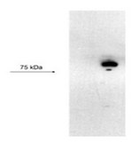 Anti-KCNN3 (AB1) antibody produced in rabbit affinity isolated antibody