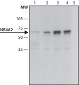 Anti-NR4A2 (N-terminal) antibody produced in rabbit ~1.5 mg/mL, affinity isolated antibody, buffered aqueous solution
