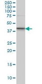 Monoclonal Anti-SGK2 antibody produced in mouse clone 3D2, purified immunoglobulin, buffered aqueous solution