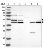 Anti-GSK3A antibody produced in rabbit Prestige Antibodies® Powered by Atlas Antibodies, affinity isolated antibody, buffered aqueous glycerol solution