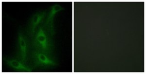 Anti-Collagen IV α6 antibody produced in rabbit affinity isolated antibody