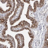 Anti-ATPIF1 antibody produced in rabbit Prestige Antibodies® Powered by Atlas Antibodies, affinity isolated antibody, buffered aqueous glycerol solution