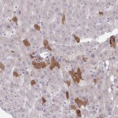 Anti-F2 antibody produced in rabbit Prestige Antibodies® Powered by Atlas Antibodies, affinity isolated antibody, buffered aqueous glycerol solution
