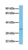 Anti-GLS2 IgG fraction of antiserum