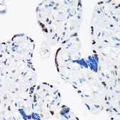 Anti-TARBP2 antibody produced in rabbit