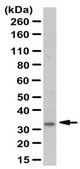Anti-Tropomyosin 4 Antibody from rabbit, purified by affinity chromatography