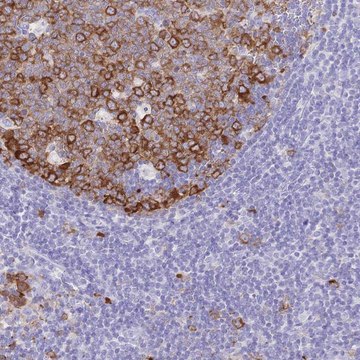 Anti-RRM1 antibody produced in rabbit Prestige Antibodies® Powered by Atlas Antibodies, affinity isolated antibody, buffered aqueous glycerol solution