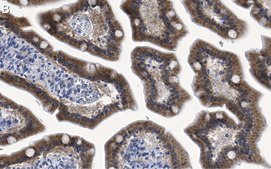 Anti-ErbB-3/HER3 Antibody, clone 1C8 ZooMAb® Rabbit Monoclonal recombinant, expressed in HEK 293 cells