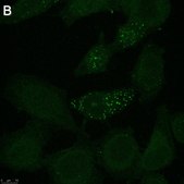 Anti-Tie-2 Antibody, clone 1C5 ZooMAb® Rabbit Monoclonal recombinant, expressed in HEK 293 cells