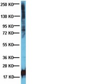 抗磷酸苏氨酸抗体 Chemicon®, from rabbit