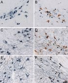 Anti-Tyrosine Hydroxylase Antibody, clone LNC1 ascites fluid, clone LNC1, Chemicon®