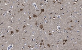 Anti-LC3B Antibody, clone 12K5, ZooMAb® Rabbit Monoclonal recombinant, expressed in HEK 293 cells