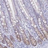Anti-CA9 antibody produced in rabbit Prestige Antibodies® Powered by Atlas Antibodies, affinity isolated antibody, buffered aqueous glycerol solution