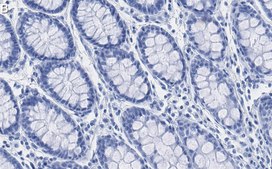 Anti-MMP-14 Antibody, clone 1J5 ZooMAb® Rabbit Monoclonal recombinant, expressed in HEK 293 cells