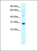 Anti-DLX5 (AB1) antibody produced in rabbit IgG fraction of antiserum