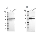 Anti-PDIA3 antibody produced in rabbit Ab2, Prestige Antibodies® Powered by Atlas Antibodies, affinity isolated antibody, buffered aqueous glycerol solution