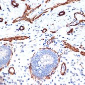 Anti-α-Actin-1 (ATCA1) antibody produced in rabbit