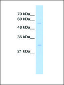 Anti-SOCS1 antibody produced in rabbit IgG fraction of antiserum