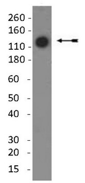 Anti-Collagen Type II Antibody, clone 6B3 clone 6B3, Chemicon®, from mouse
