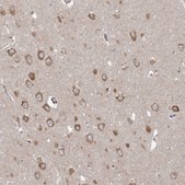 Anti-PPP2R3A antibody produced in rabbit Prestige Antibodies® Powered by Atlas Antibodies, affinity isolated antibody, buffered aqueous glycerol solution