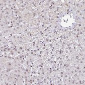 Anti-TRIM28 antibody produced in rabbit Prestige Antibodies® Powered by Atlas Antibodies, affinity isolated antibody, buffered aqueous glycerol solution
