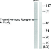 Anti-Thyroid Hormone Receptor α, N-Terminal antibody produced in rabbit affinity isolated antibody
