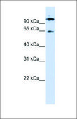 Anti-RUNX1T1 antibody produced in rabbit affinity isolated antibody