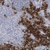 Anti-CD38 antibody produced in rabbit Prestige Antibodies® Powered by Atlas Antibodies, affinity isolated antibody, buffered aqueous glycerol solution