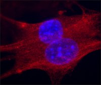 抗 肌钙蛋白 T 抗体，小鼠单克隆 clone JLT-12, purified from hybridoma cell culture
