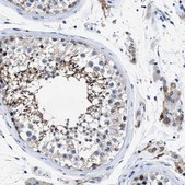 Anti-HOOK1 antibody produced in rabbit Prestige Antibodies® Powered by Atlas Antibodies, affinity isolated antibody, buffered aqueous glycerol solution, Ab2