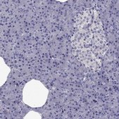 Anti-SLC6A2 Prestige Antibodies® Powered by Atlas Antibodies, affinity isolated antibody
