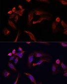 Anti-TYMS antibody produced in rabbit