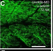 单克隆 抗-α-肌动蛋白（肌小节） 小鼠抗 clone EA-53, ascites fluid