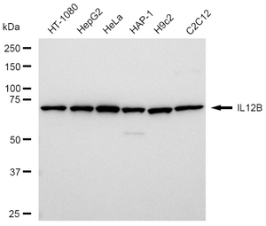 Anti IL12B Antibody, clone 23GB5970, Rabbit Monoclonal clone 23GB5970, recombinant rabbit monoclonal, expressed in HEK293 cells
