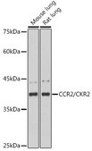 Anti-CCR2/CKR2 Antibody, clone 10L1L6, Rabbit Monoclonal