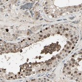 Anti-NUAK2 antibody produced in rabbit Prestige Antibodies® Powered by Atlas Antibodies, affinity isolated antibody, buffered aqueous glycerol solution