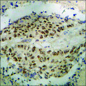 Anti-phospho-MAPKAPK2 (pThr334) antibody produced in rabbit affinity isolated antibody