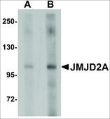 Anti-JMJD2A antibody produced in rabbit affinity isolated antibody, buffered aqueous solution