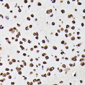 Anti-Phospho-STAT5A-Y694 antibody produced in rabbit