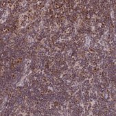 Anti-POLA2 antibody produced in rabbit Prestige Antibodies® Powered by Atlas Antibodies, affinity isolated antibody, buffered aqueous glycerol solution