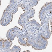 Anti-MAGI1 antibody produced in rabbit Prestige Antibodies® Powered by Atlas Antibodies, affinity isolated antibody, buffered aqueous glycerol solution, ab2