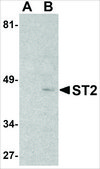 抗-ST2 兔抗 affinity isolated antibody, buffered aqueous solution