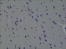 Anti-ALK antibody, Rabbit monoclonal recombinant, expressed in HEK 293 cells, clone RM361, purified immunoglobulin